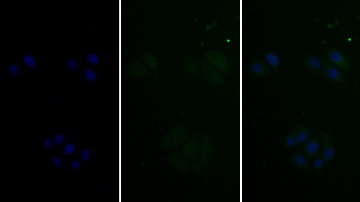 Monoclonal Antibody to Thymidine Kinase 1, Soluble (TK1)