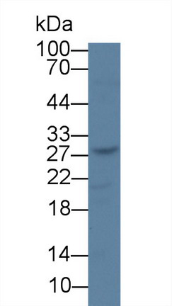 Monoclonal Antibody to Thymidine Kinase 1, Soluble (TK1)