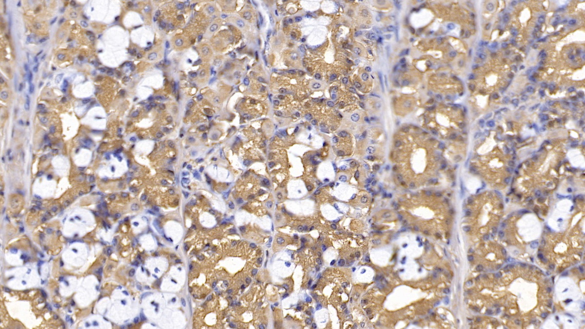 Monoclonal Antibody to Thymidine Kinase 1, Soluble (TK1)