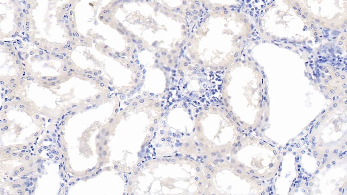 Monoclonal Antibody to Renalase (RNLS)