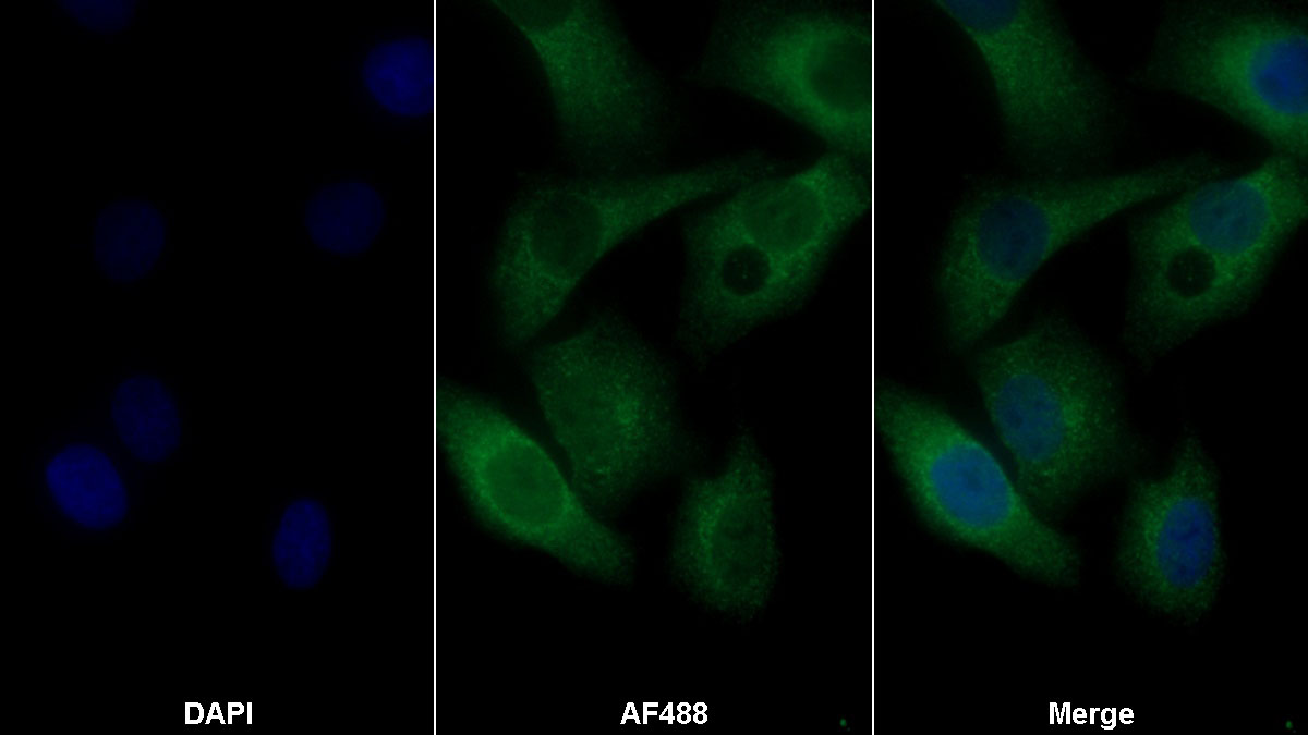 Monoclonal Antibody to Peptidase Inhibitor 3, Skin Derived (PI3)