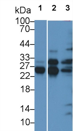 Monoclonal Antibody to Cathepsin B (CTSB)