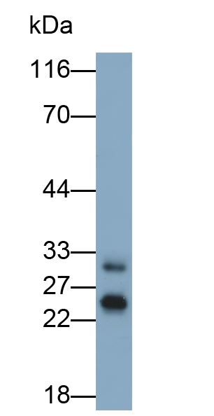 Monoclonal Antibody to Cathepsin B (CTSB)