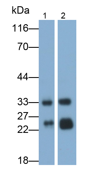 Monoclonal Antibody to Cathepsin B (CTSB)