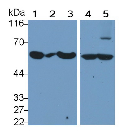 Monoclonal Antibody to Carcinoembryonic Antigen Related Cell Adhesion Molecule 1 (CEACAM1)