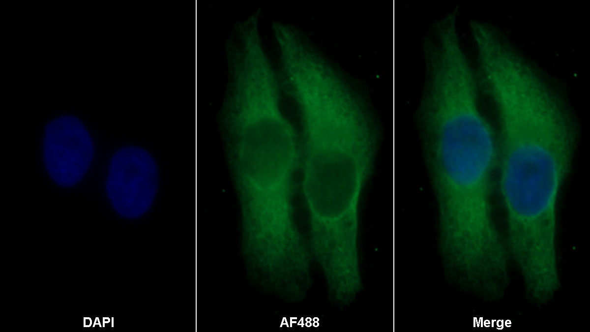 Monoclonal Antibody to Carcinoembryonic Antigen Related Cell Adhesion Molecule 1 (CEACAM1)