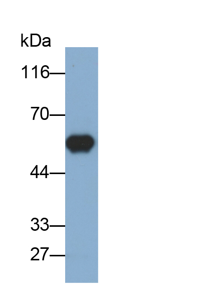 Monoclonal Antibody to Carcinoembryonic Antigen Related Cell Adhesion Molecule 1 (CEACAM1)