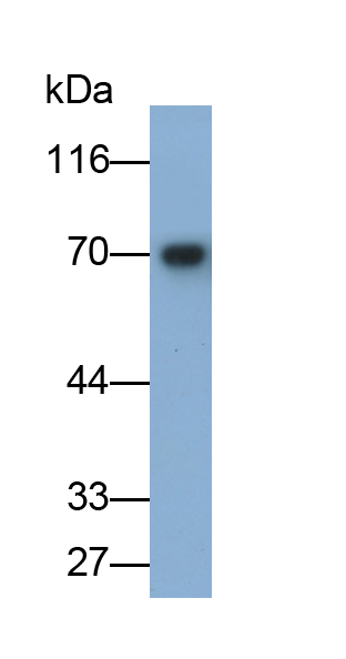 Monoclonal Antibody to Carcinoembryonic Antigen Related Cell Adhesion Molecule 1 (CEACAM1)