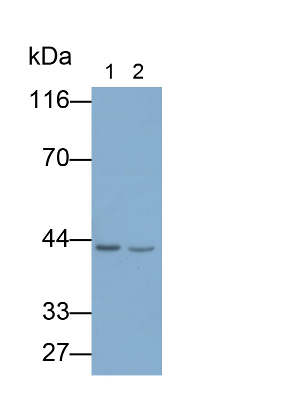 Monoclonal Antibody to Carcinoembryonic Antigen Related Cell Adhesion Molecule 8 (CEACAM8)