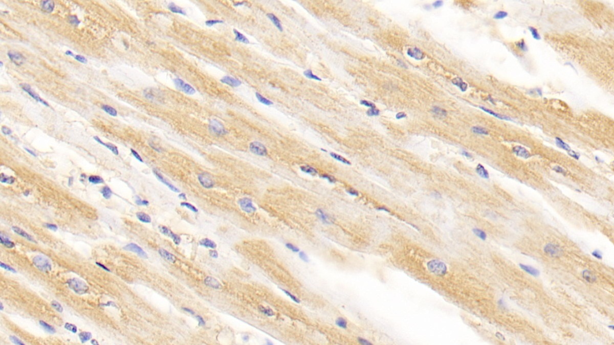 Monoclonal Antibody to Arginyl tRNA Synthetase (RARS)