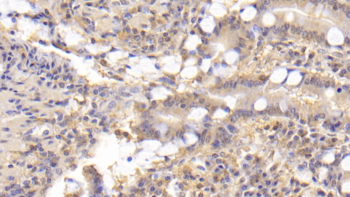 Monoclonal Antibody to Arginyl tRNA Synthetase (RARS)