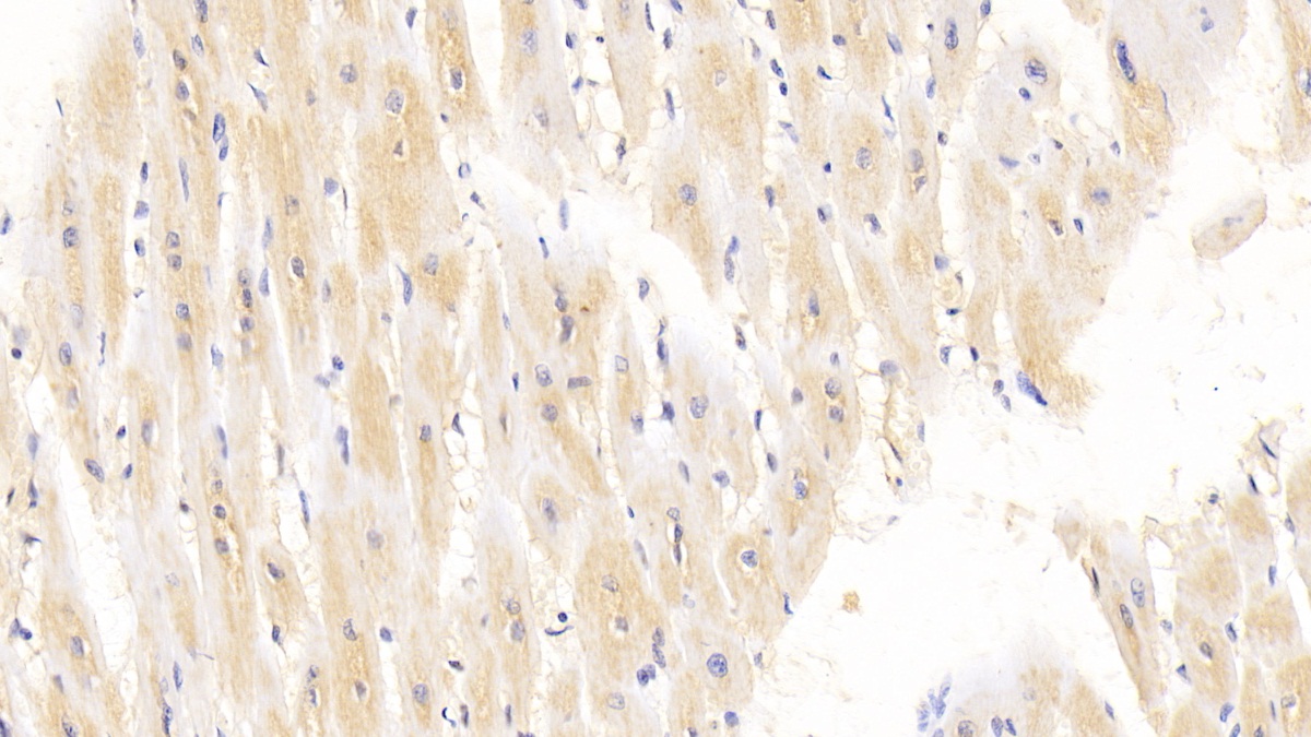 Monoclonal Antibody to Arginyl tRNA Synthetase (RARS)