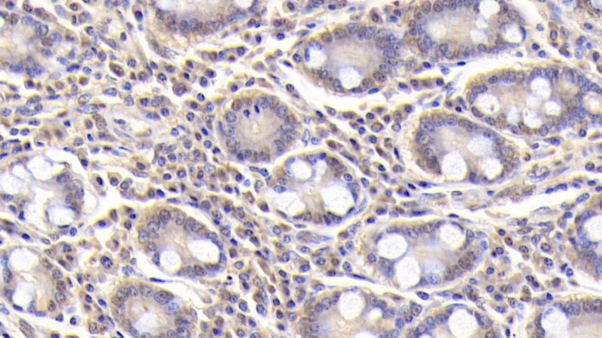 Monoclonal Antibody to Arginyl tRNA Synthetase (RARS)