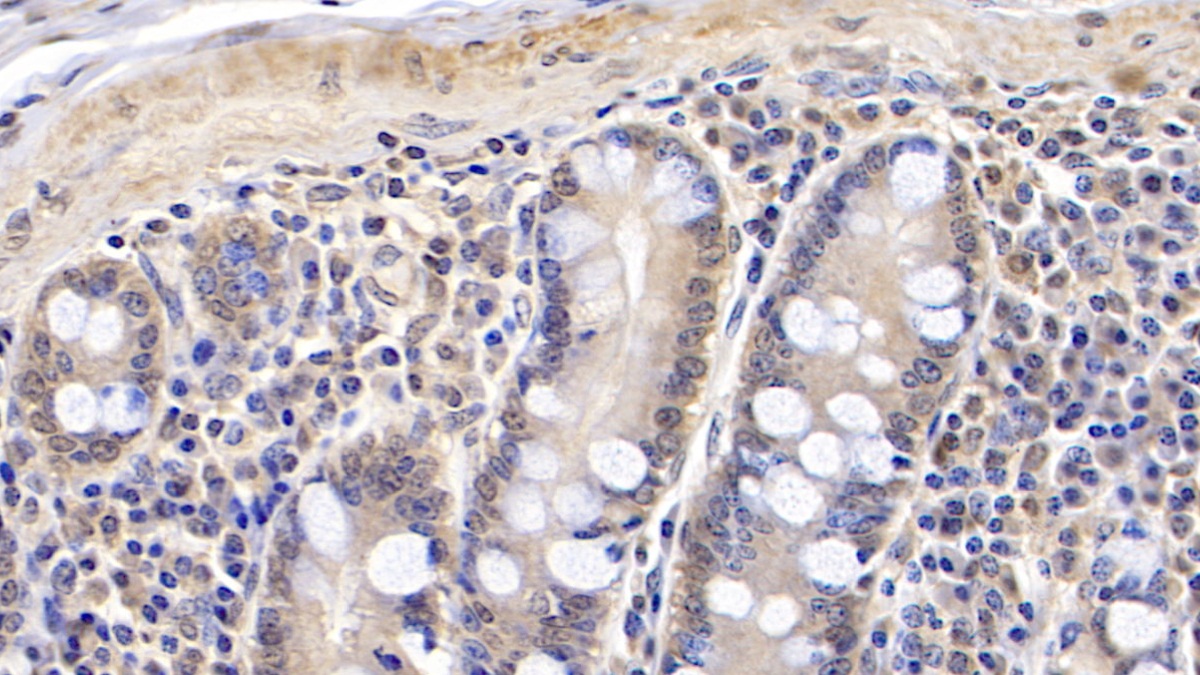 Monoclonal Antibody to Arginyl tRNA Synthetase (RARS)