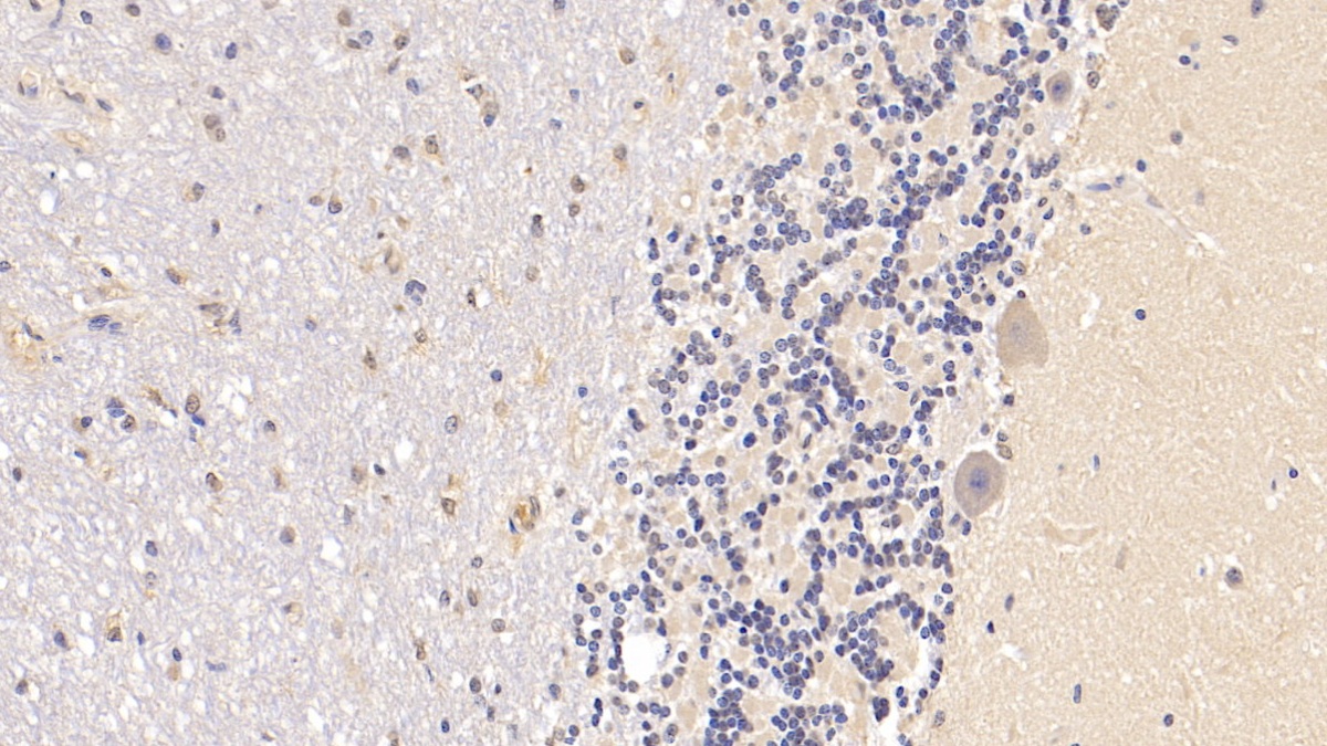 Monoclonal Antibody to Arginyl tRNA Synthetase (RARS)