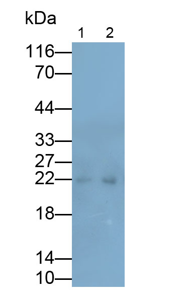 Monoclonal Antibody to Follicle Stimulating Hormone Beta (FSHb)