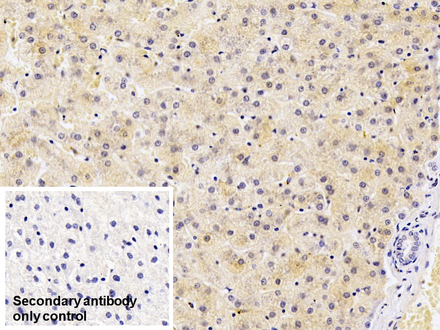 Monoclonal Antibody to Ferritin, Light Polypeptide (FTL)