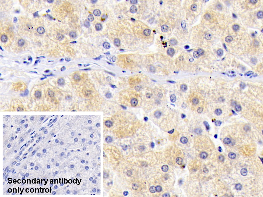 Monoclonal Antibody to Ferritin, Light Polypeptide (FTL)