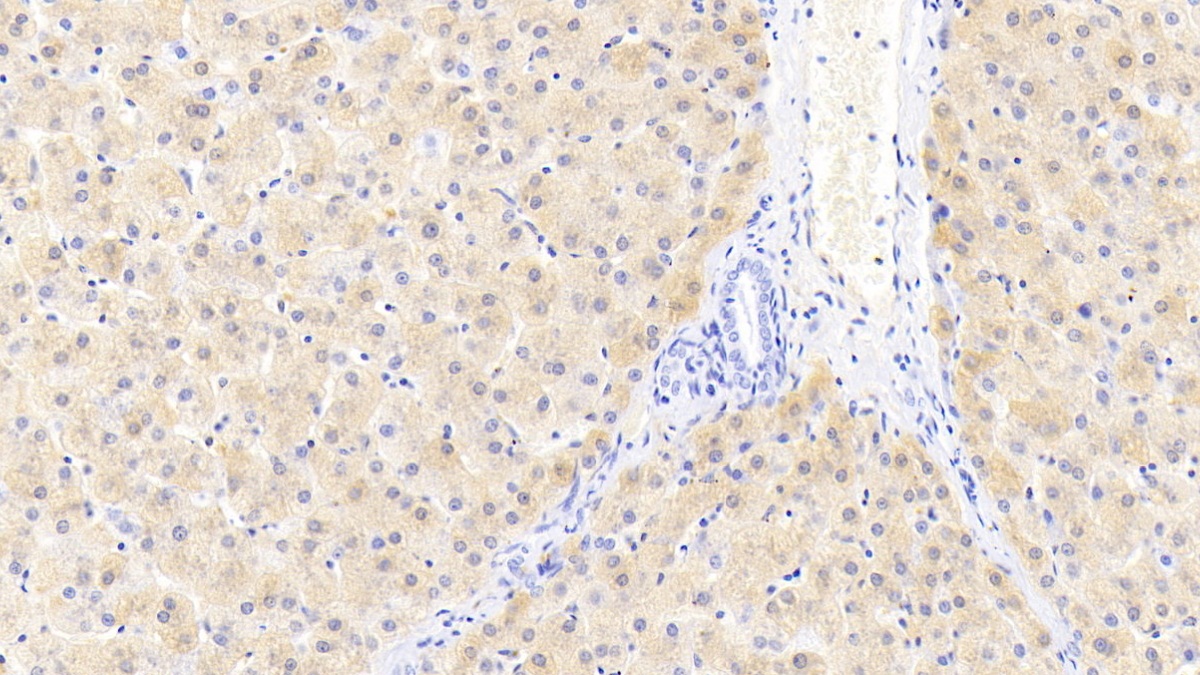 Monoclonal Antibody to Ferritin, Light Polypeptide (FTL)