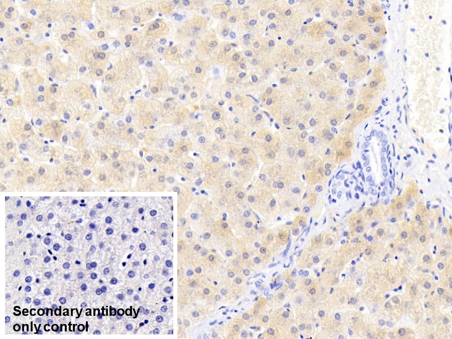 Monoclonal Antibody to Ferritin, Light Polypeptide (FTL)