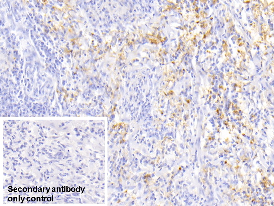 Monoclonal Antibody to Ferritin, Light Polypeptide (FTL)