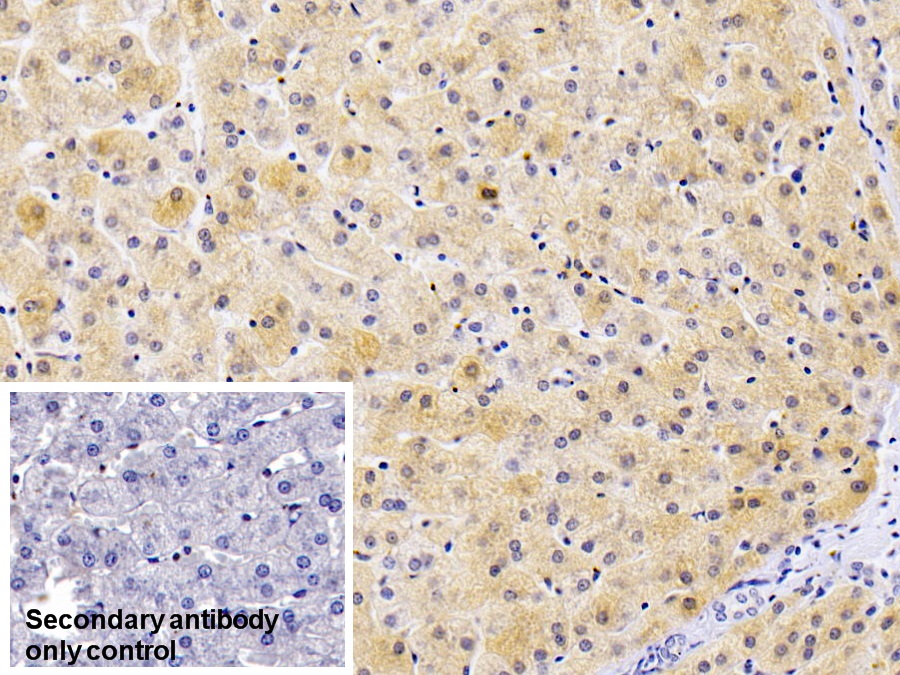 Monoclonal Antibody to Ferritin, Light Polypeptide (FTL)