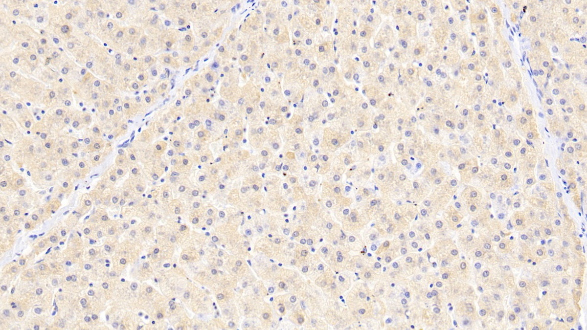 Monoclonal Antibody to Ferritin, Light Polypeptide (FTL)