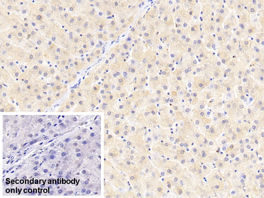 Monoclonal Antibody to Ferritin, Light Polypeptide (FTL)