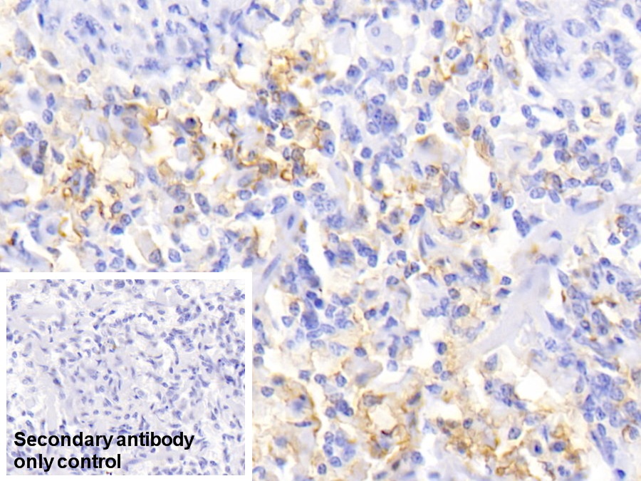 Monoclonal Antibody to Ferritin, Light Polypeptide (FTL)