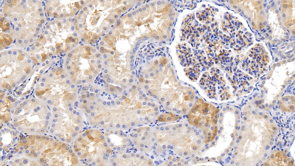 Monoclonal Antibody to Ferritin, Heavy Polypeptide (FTH)