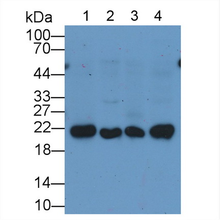 Monoclonal Antibody to Ferritin, Heavy Polypeptide (FTH)