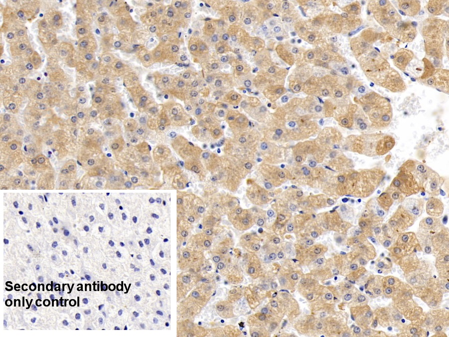 Monoclonal Antibody to Ferritin, Heavy Polypeptide (FTH)