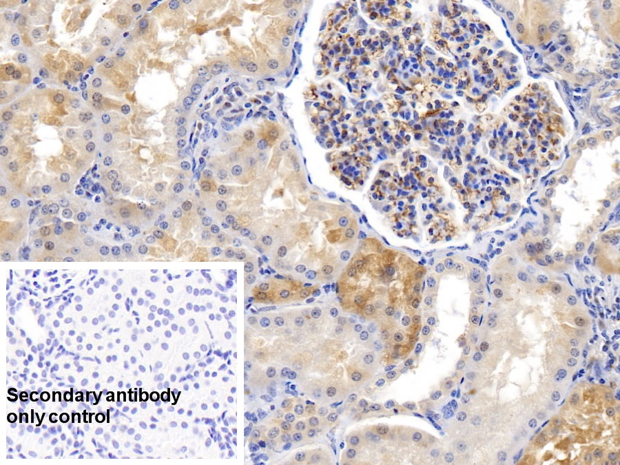 Monoclonal Antibody to Ferritin, Heavy Polypeptide (FTH)