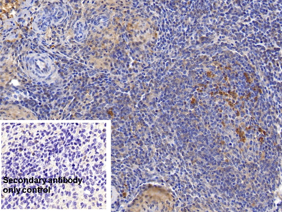 Monoclonal Antibody to Ferritin, Heavy Polypeptide (FTH)