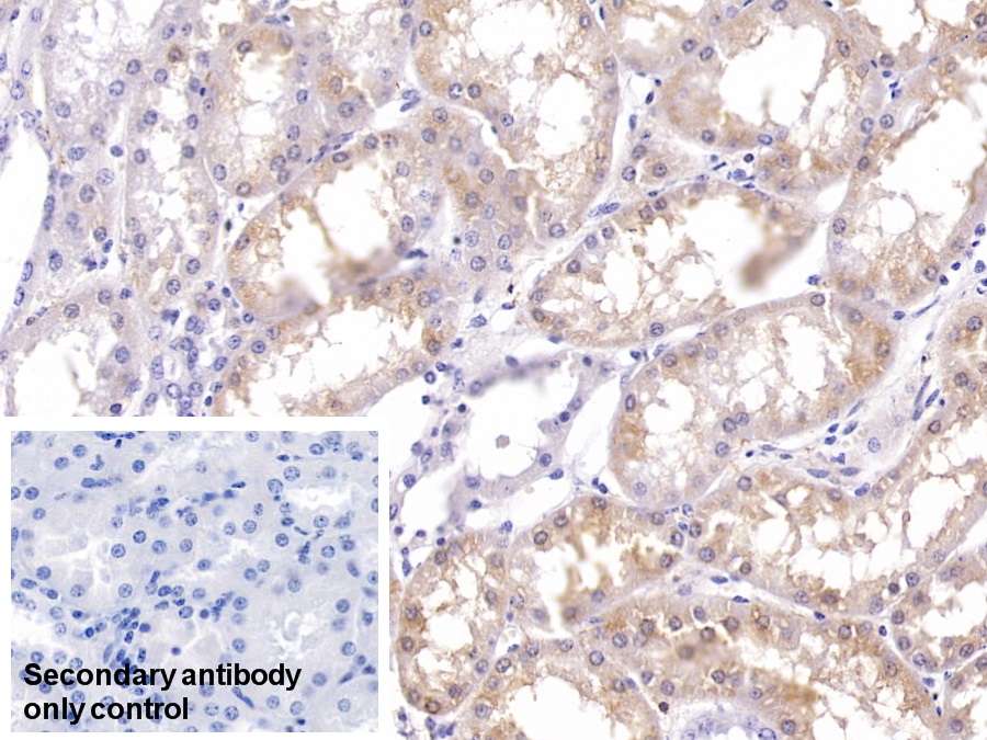 Monoclonal Antibody to Ferritin, Heavy Polypeptide (FTH)