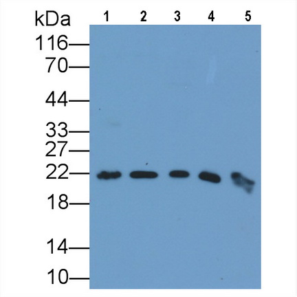 Monoclonal Antibody to Ferritin, Heavy Polypeptide (FTH)