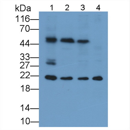 Monoclonal Antibody to Ferritin, Heavy Polypeptide (FTH)