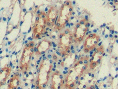 Monoclonal Antibody to Ferritin, Heavy Polypeptide (FTH)