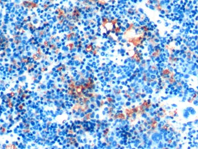 Monoclonal Antibody to Ferritin, Heavy Polypeptide (FTH)