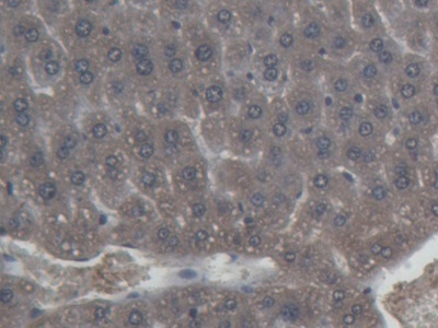 Monoclonal Antibody to Ferritin, Heavy Polypeptide (FTH)