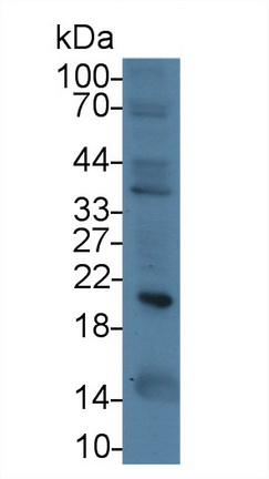 Monoclonal Antibody to Ferritin, Heavy Polypeptide (FTH)