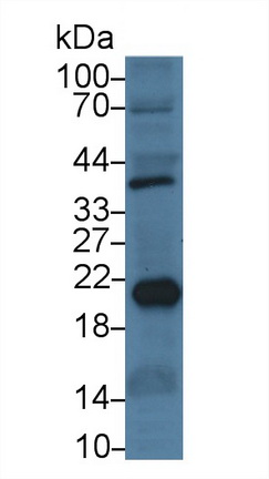 Monoclonal Antibody to Ferritin, Heavy Polypeptide (FTH)