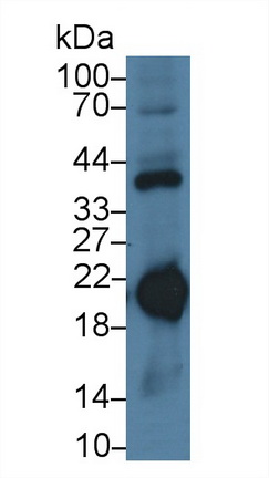 Monoclonal Antibody to Ferritin, Heavy Polypeptide (FTH)