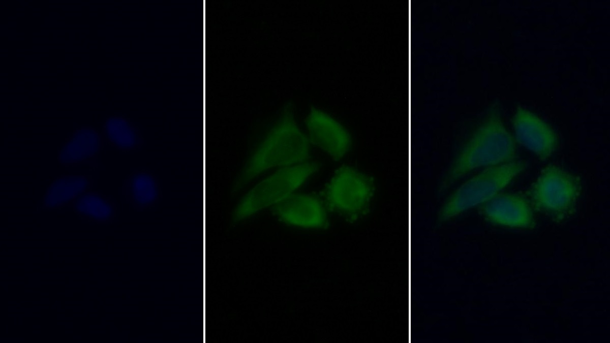 Monoclonal Antibody to Ferritin, Heavy Polypeptide (FTH)