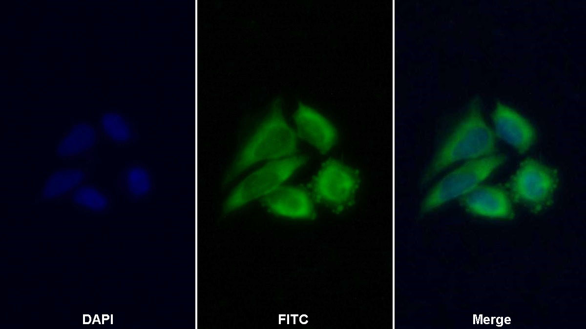 Monoclonal Antibody to Ferritin, Heavy Polypeptide (FTH)