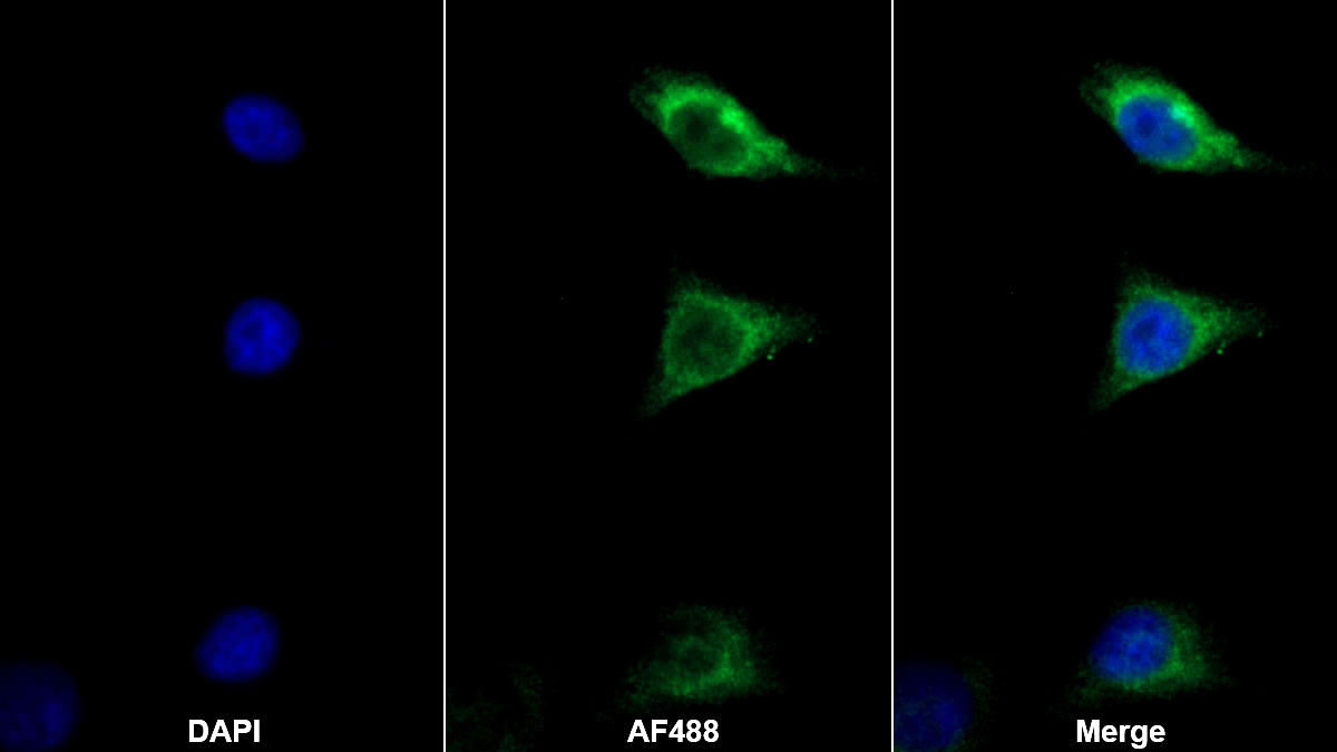 Monoclonal Antibody to Carbonic Anhydrase III, Muscle Specific (CA3)