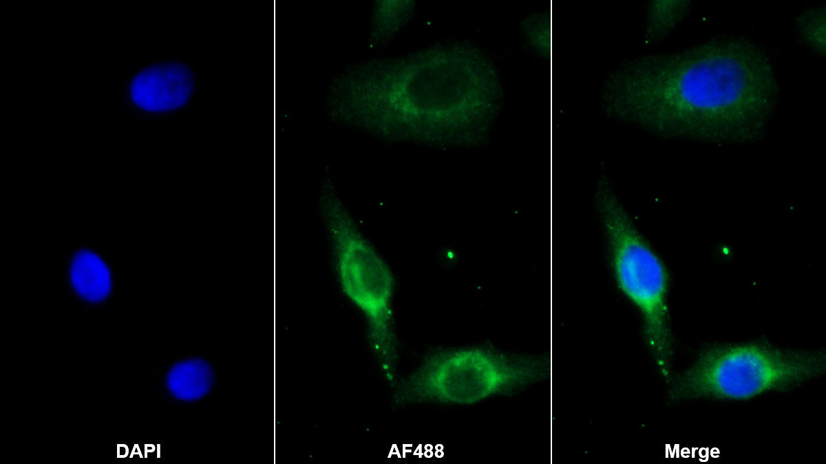 Monoclonal Antibody to Carbonic Anhydrase III, Muscle Specific (CA3)