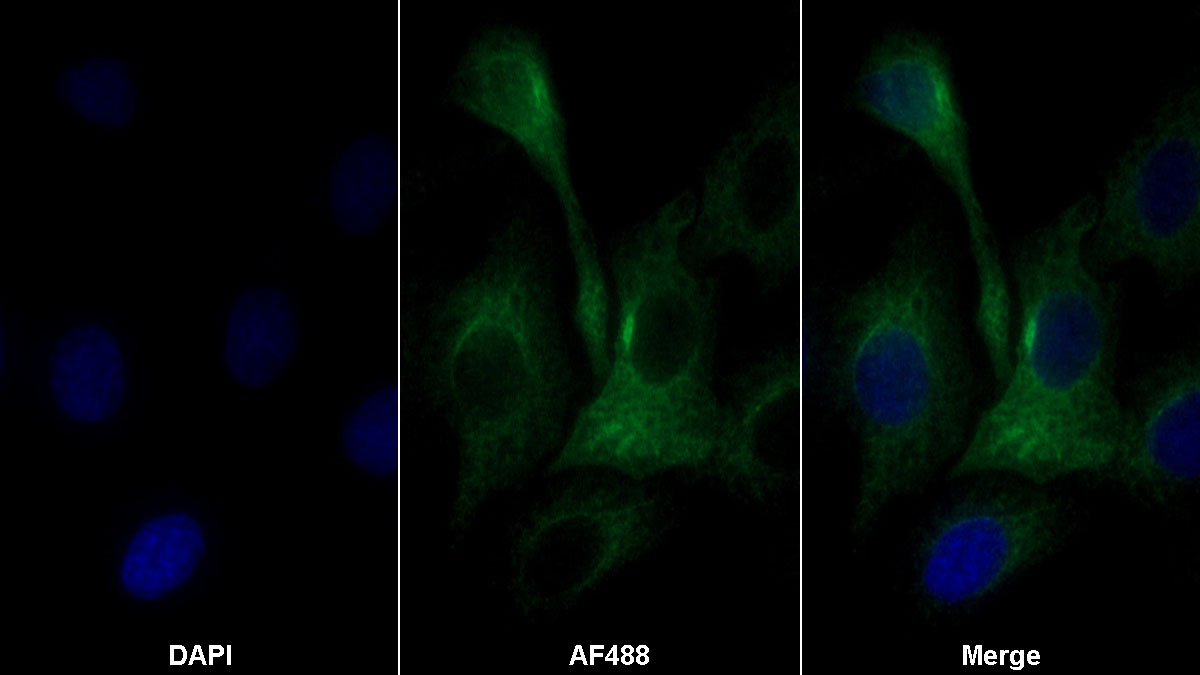 Monoclonal Antibody to Carbonic Anhydrase IV (CA4)