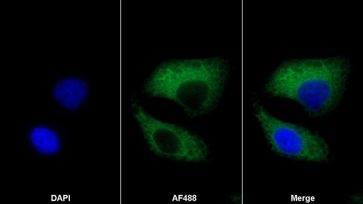 Monoclonal Antibody to Carbonic Anhydrase IV (CA4)