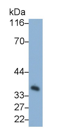 Monoclonal Antibody to Carbonic Anhydrase IV (CA4)